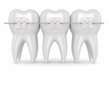 Orthodontistes